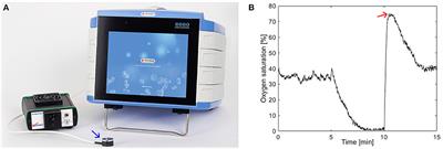 Impaired Microcirculation and Vascular Hemodynamics in Relation to Macrocirculation in Patients With Systemic Lupus Erythematosus